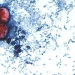 First two US deaths linked to diarrhea-inducing parasite confirmed